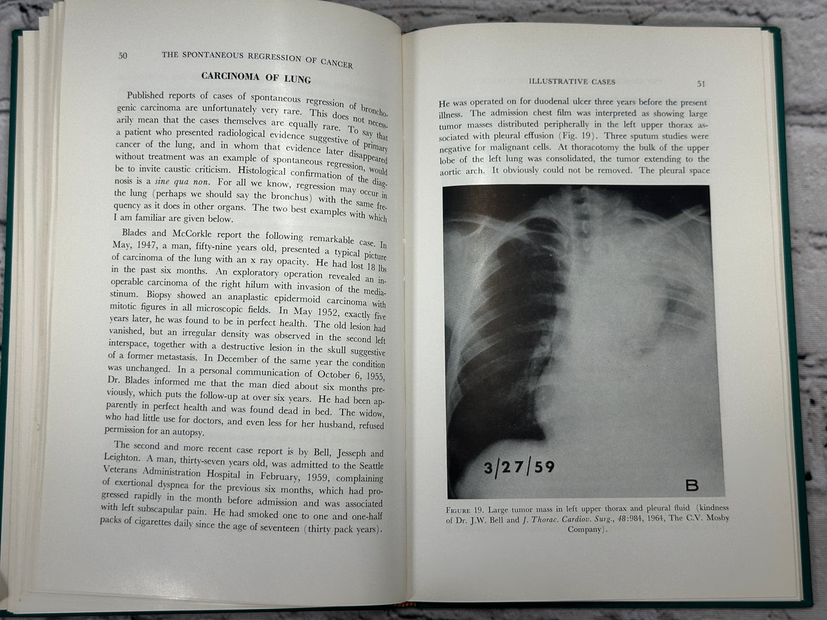 The Spontaneous Regression of Cancer by William Boyd, 1966 Charles C Thomas hardcover - interior illustrations