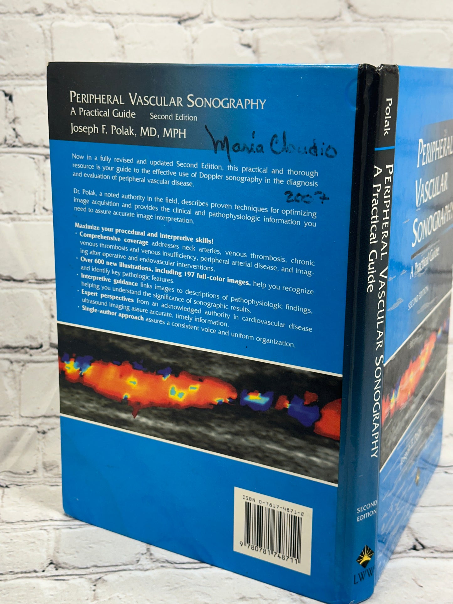 Peripheral Vascular Sonography: A Practical Guide by Joseph Polak [2nd Edition]