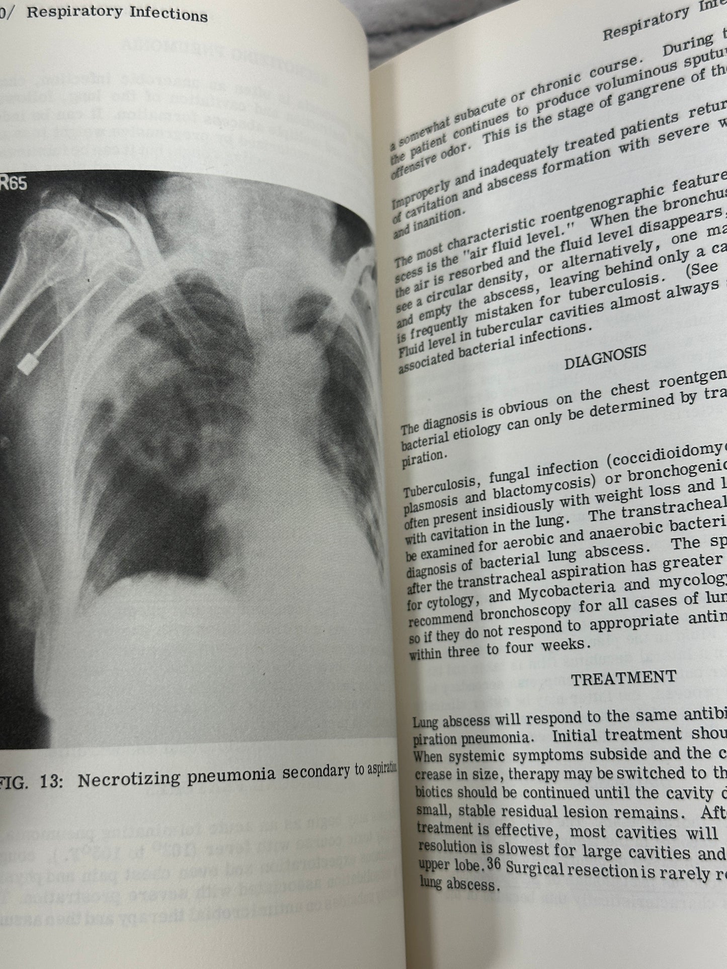 Infectious Diseases: Focus on Clinical Diagnosis by Haragopal Thadepalli [1980]