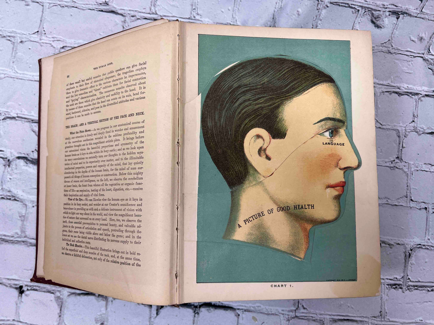 Library of Health: Complete Guide to Prevention and Cure of Disease