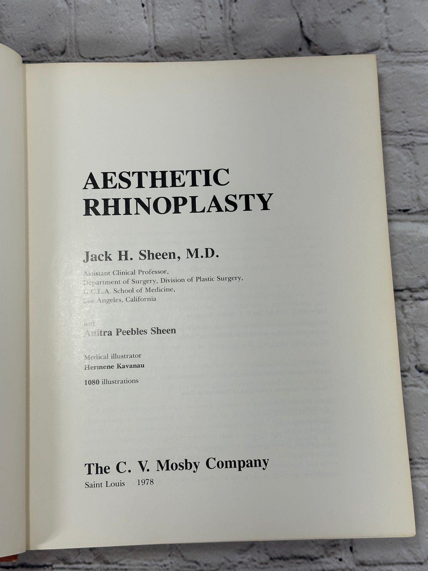 Aesthetic Rhinoplasty By Jack H Sheen [First Print · 1978]