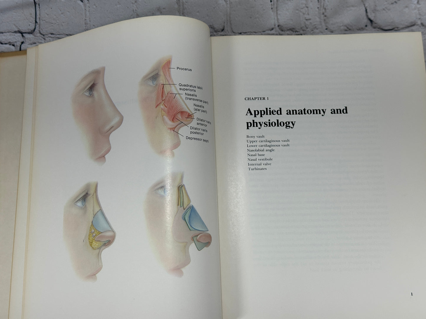 Aesthetic Rhinoplasty By Jack H Sheen [First Print · 1978]