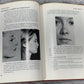 Aesthetic Rhinoplasty By Jack H Sheen [First Print · 1978]