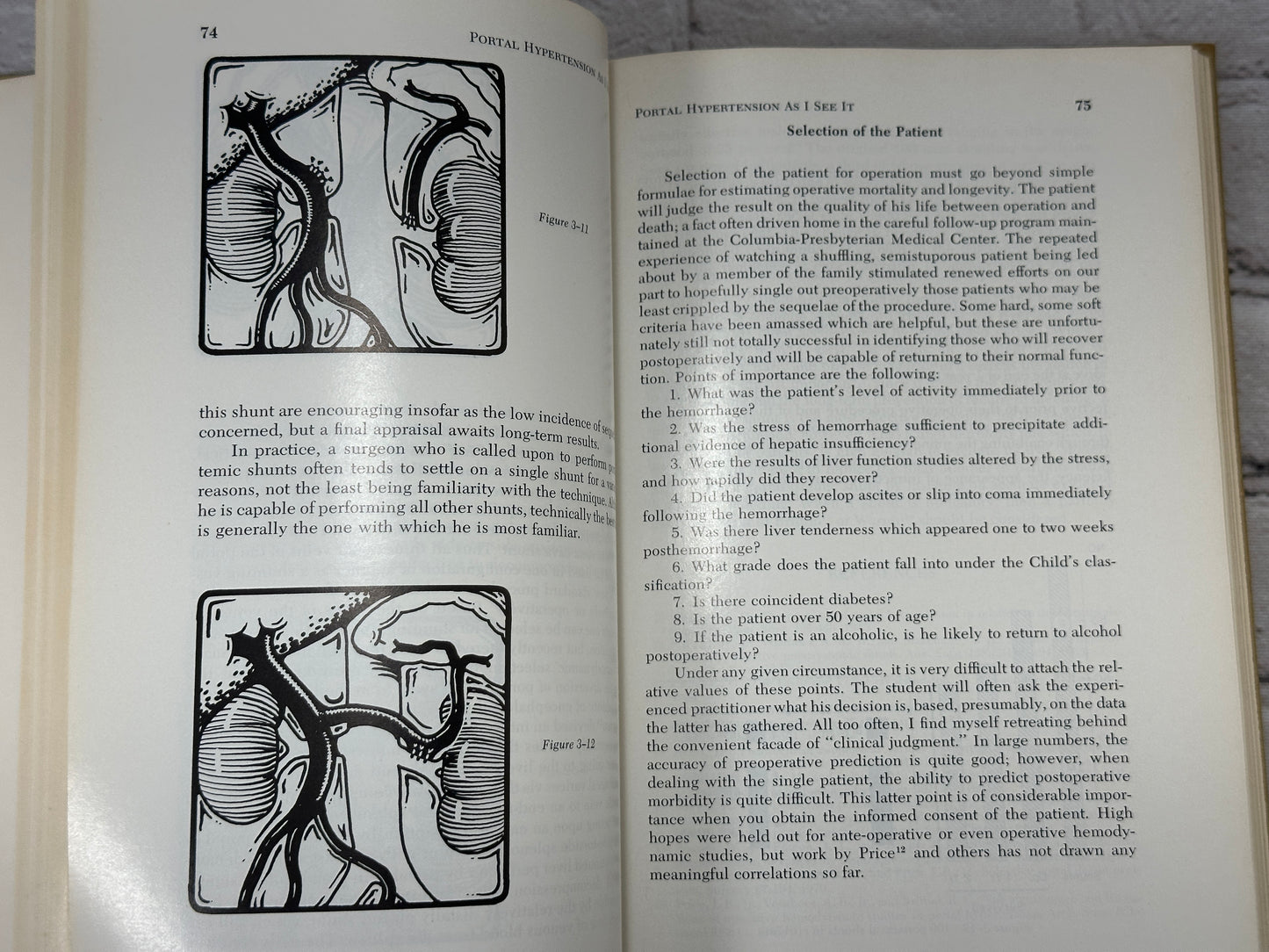 Portal Hypertension [Major Problems in Clinical Surgery · Volume 14 · 1974]