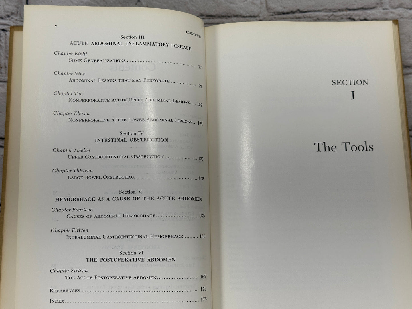 The Acute Abdomen [Major Problems in Clinical Surgery · Volume 10 · 1969]