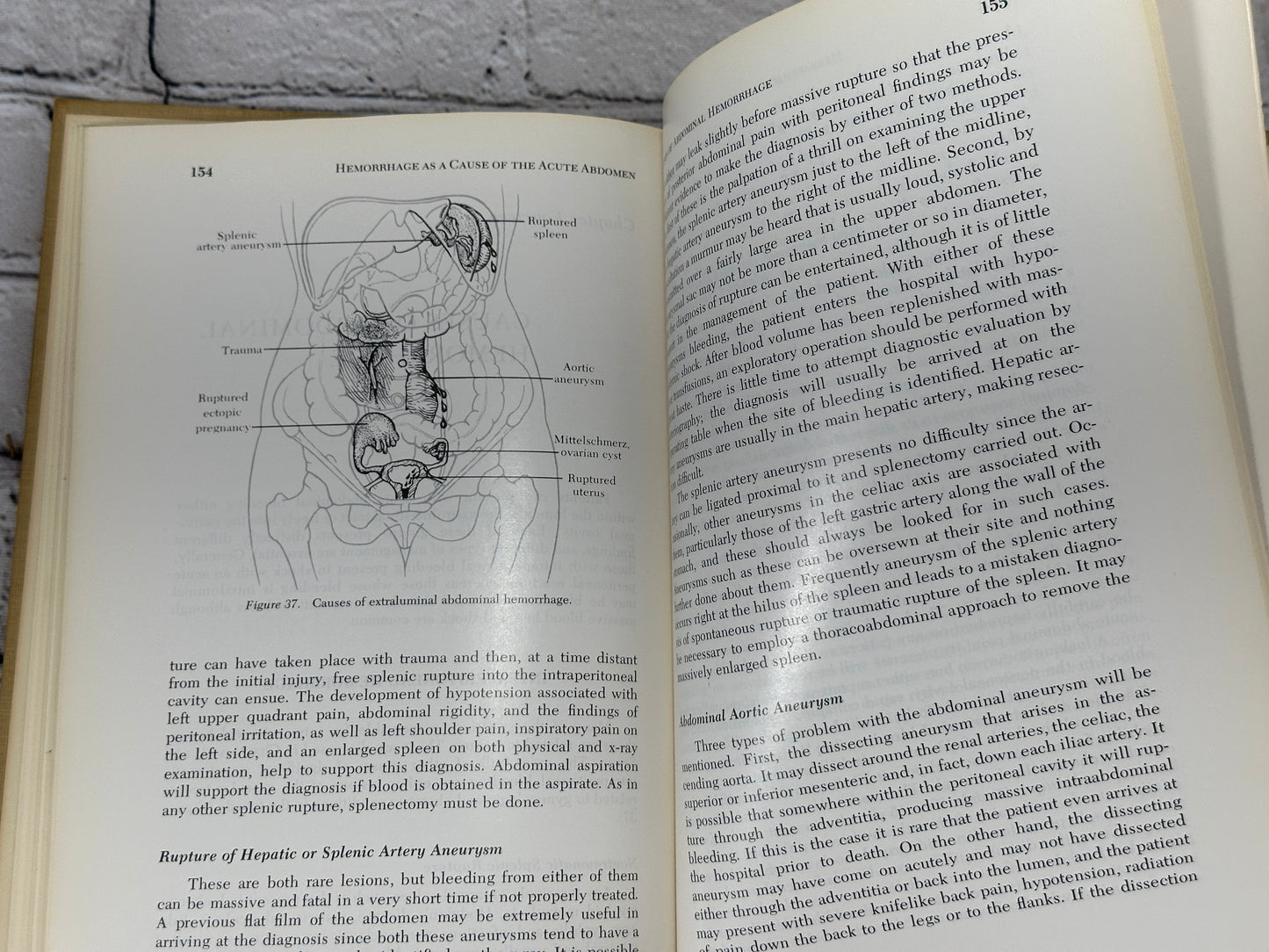 The Acute Abdomen [Major Problems in Clinical Surgery · Volume 10 · 1969]