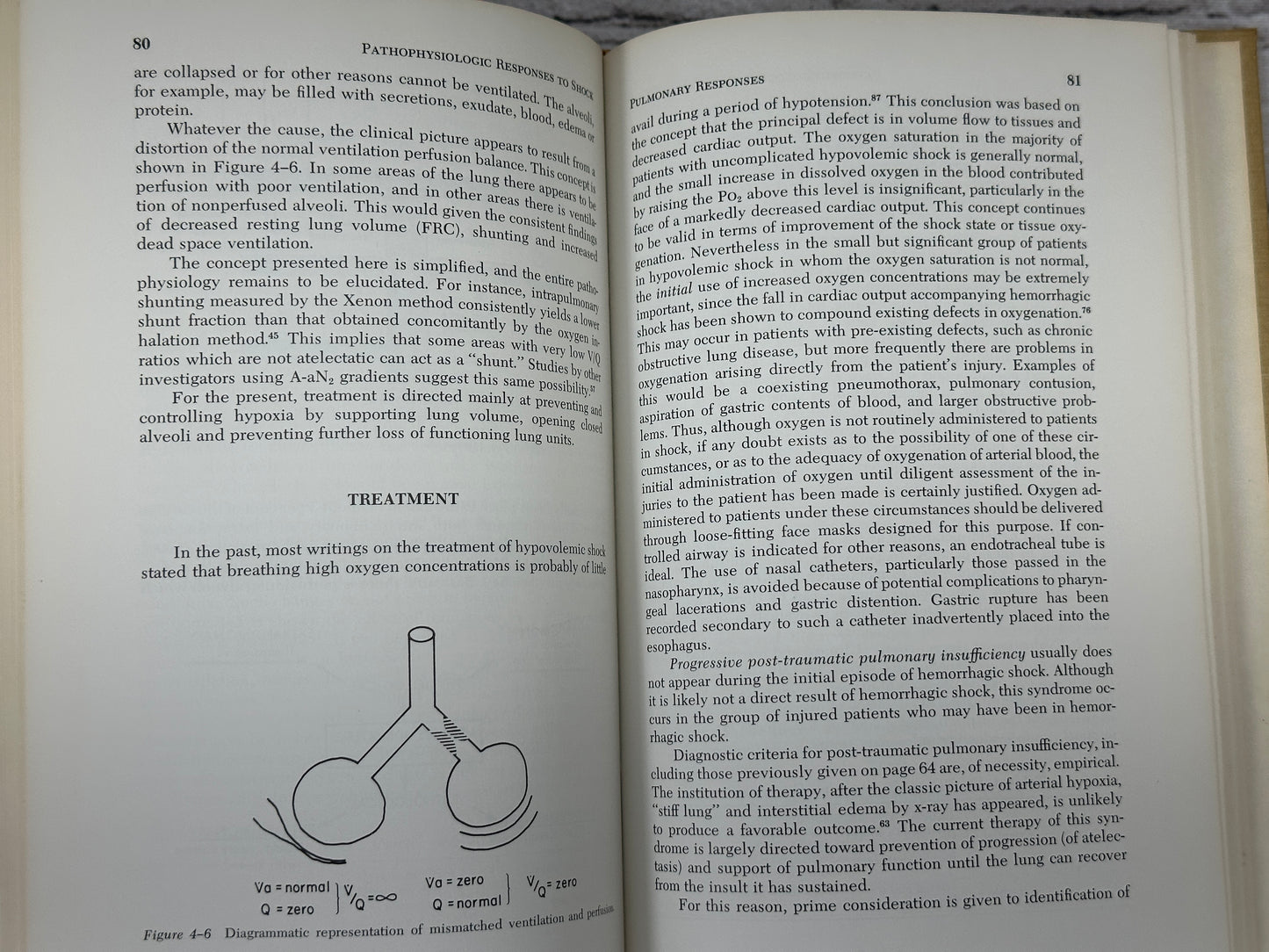 Shock by Tom Shires [Major Problems in Clinical Surgery · Volume 13 · 1973]