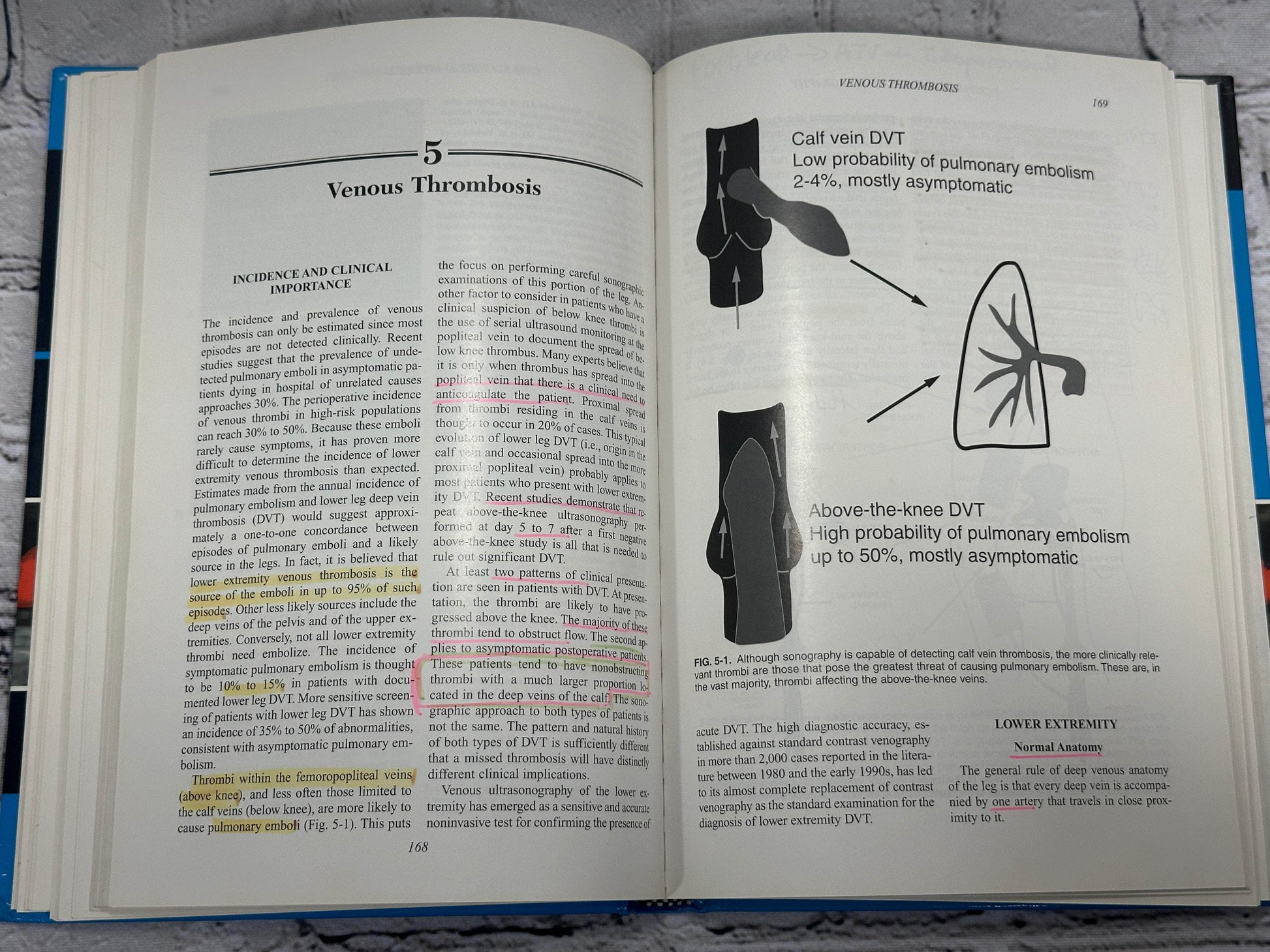 Flipped Pages Peripheral Vascular Sonography: A Practical Guide by Joseph Polak [2nd Edition]