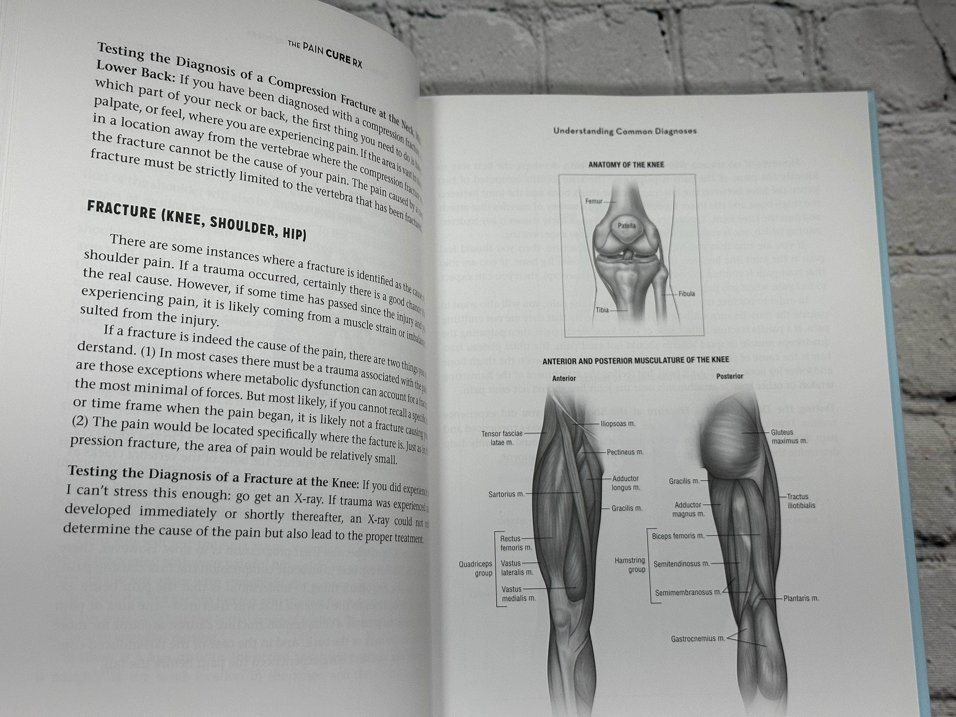 Flipped Pages The Pain Cure Rx: The Yass Method... by Dr Mitchell Yass [2015 · First Edition]