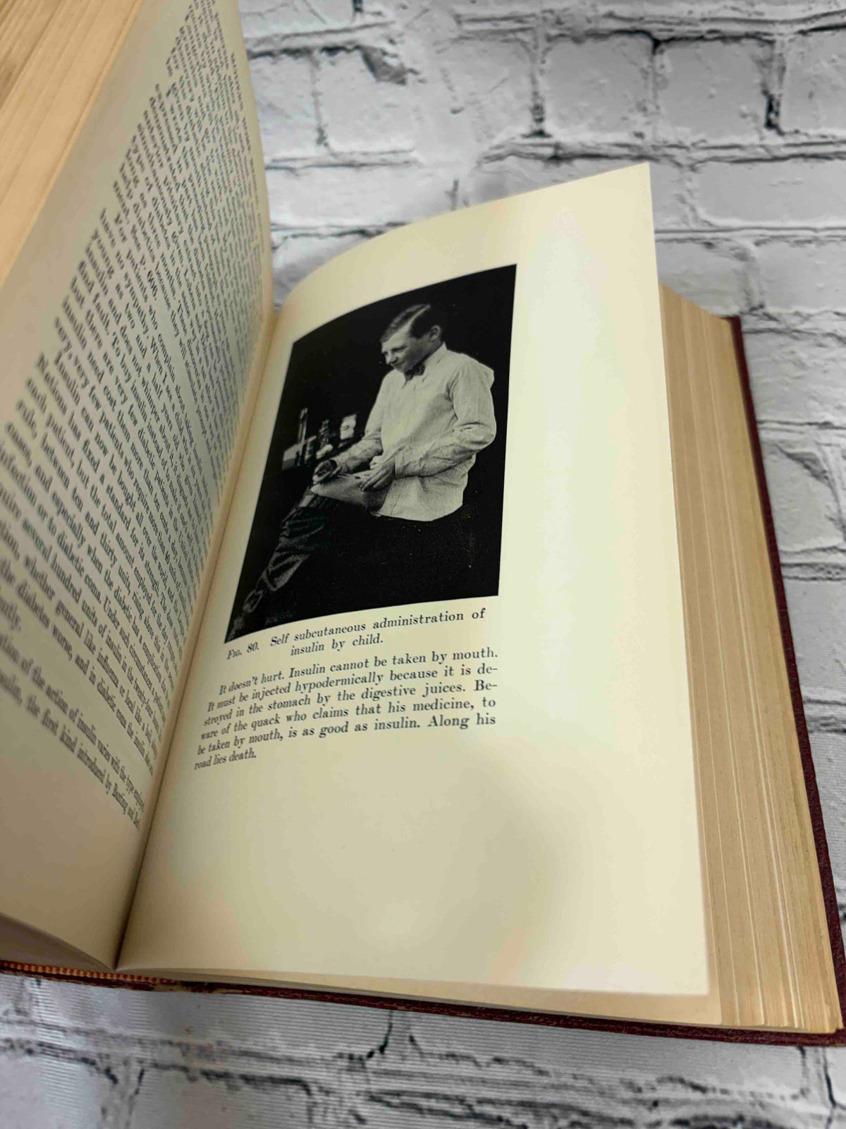Modern Home Medical Adviser by Morris Fishbein, 1942 Doubleday, Doran & Company hardcover - Fig. 80 photograph