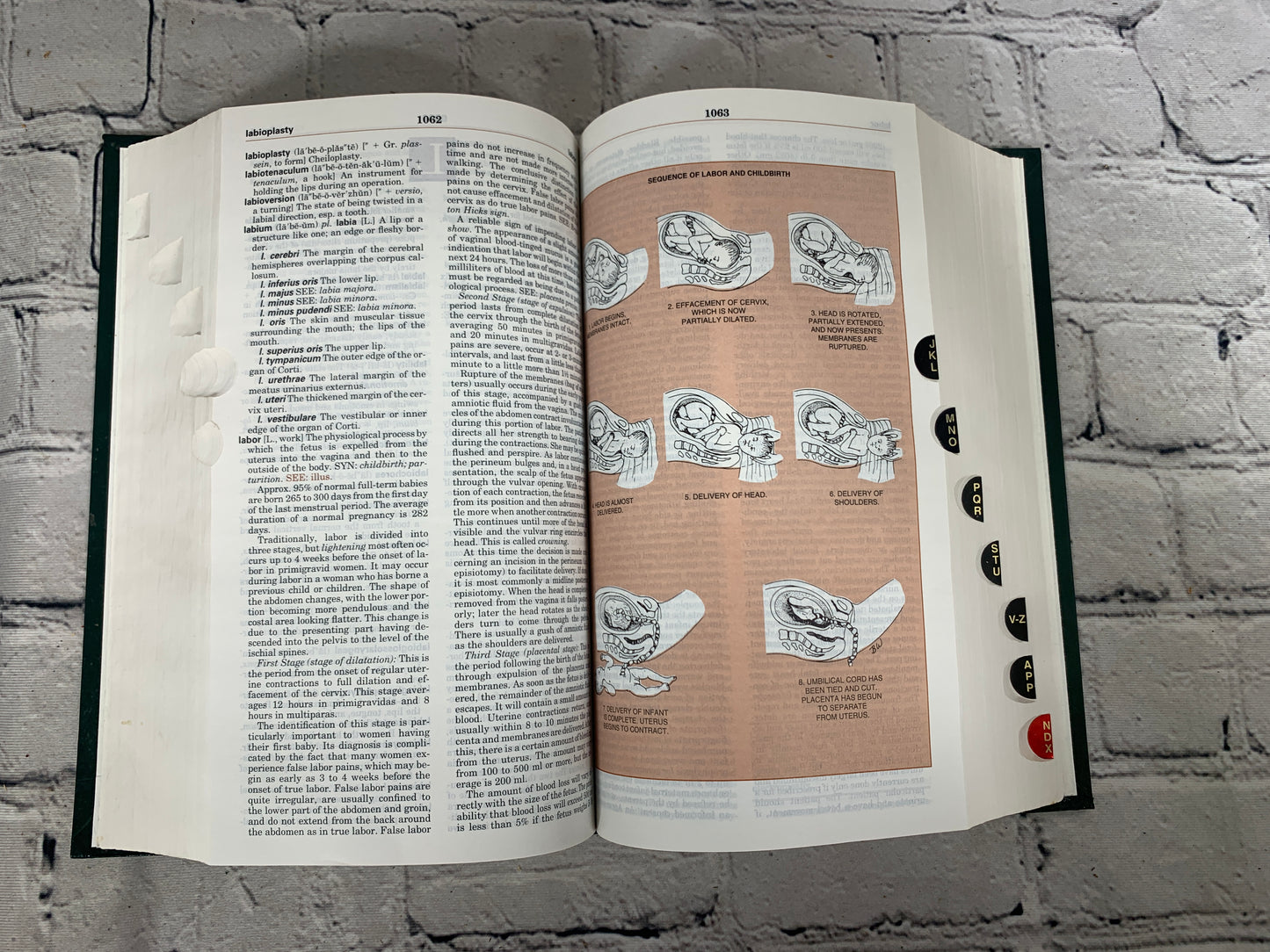 Taber’s  Cyclopedic Medical Dictionary #18 [1997]