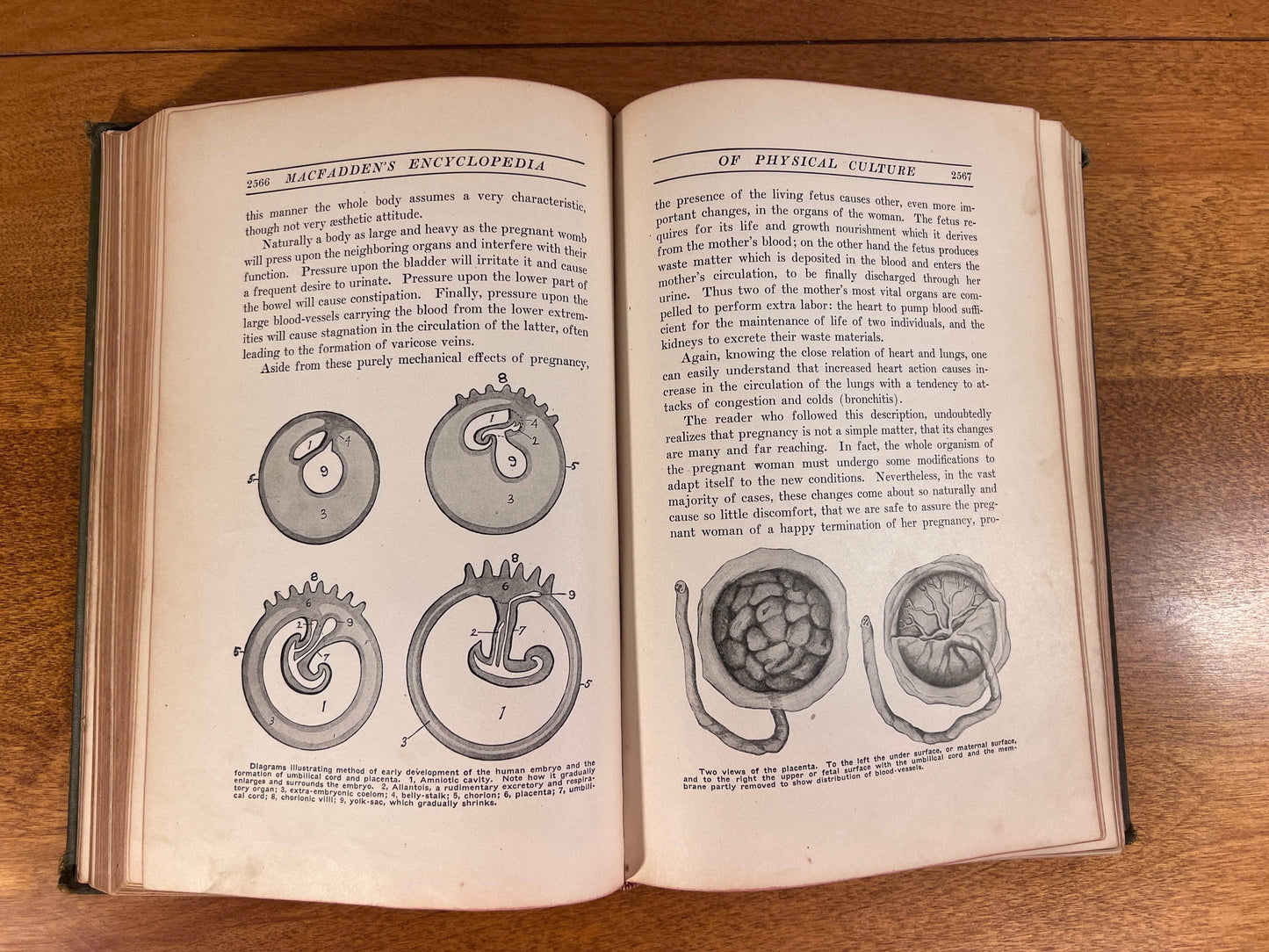 Flipped Pages MacFadden's Enyclopedia of Physical Culture Vol. 5 - Sex Hygiene, Parenthood and Child Training [1920]